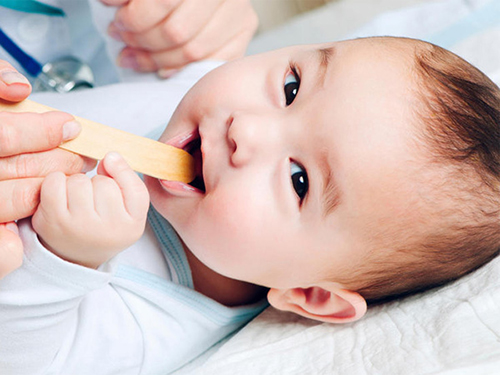 Chăm sóc và điều trị bệnh nấm lưỡi cho trẻ