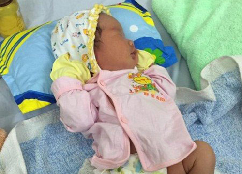 Gãy xương đòn ở trẻ sơ sinh hầu như không gây nên ảnh hưởng nghiêm trọng