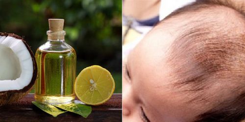 Những tinh chất trong dầu dừa giúp trị cứt trâu trên đầu con một cách hiệu quả