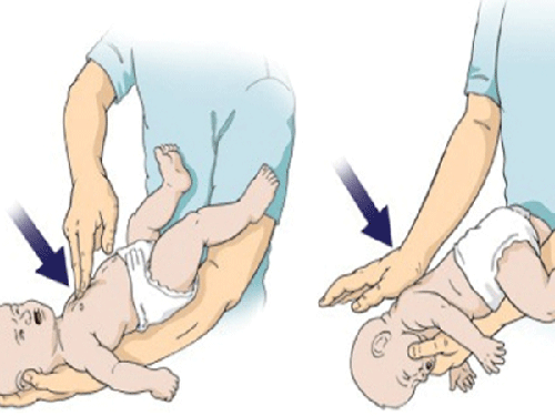 Cách xử lý khi trẻ bị sặc sữa lên mũi