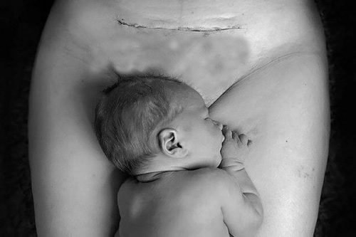 Sinh mổ sẽ luôn tồn tại những rủi ro với mẹ và bé