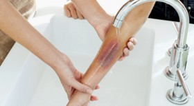 Bố mẹ cần làm gì để giúp trẻ thoát khỏi đám cháy an toàn nhất?
