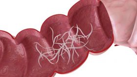Có phải bệnh giun kim là bệnh lý nguy hiểm ở trẻ em