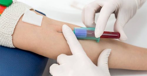 Những điều cần biết khi xét nghiệm máu