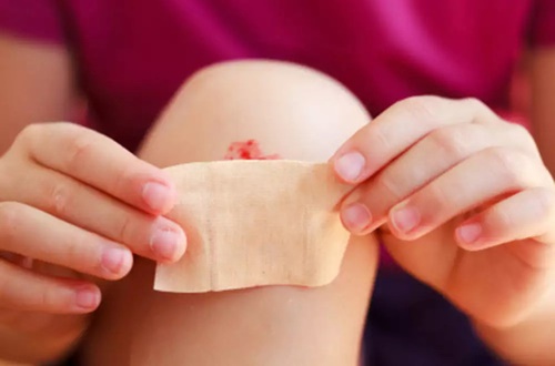 Cách điều trị vết thương nhỏ ở trẻ chuẩn như chuyên gia