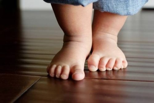Tập đi quá sớm là một trong những nguyên nhân khiến chân trẻ bị cong