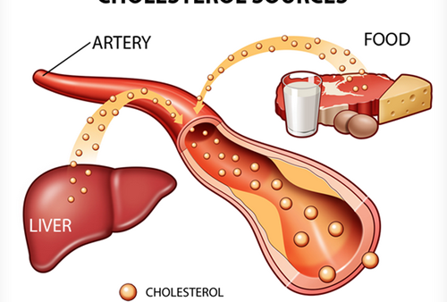 Vì sao người bị rối loạn lipid máu có nguy cơ tử vong rất cao?