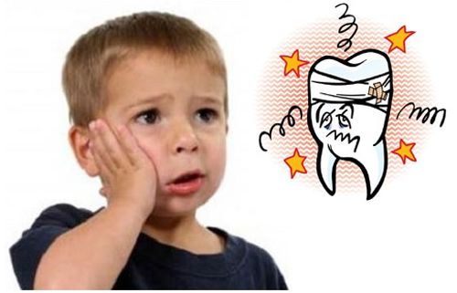 Đặc điểm lâm sàng của sâu răng trẻ em