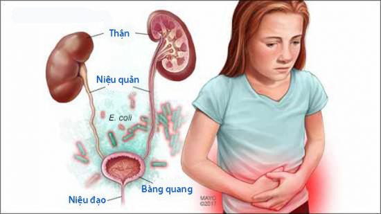 Chăm sóc và phòng bệnh nhiễm trùng đường tiểu cho trẻ