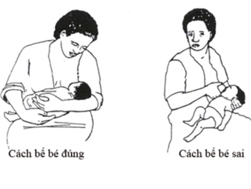  Tư thế cho con bú không đúng là một trong các nguyên nhân gây đau lưng