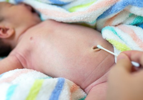 Vệ sinh rốn trẻ sơ sinh đúng cách để bảo vệ cho bé khỏi các bệnh nguy hiểm