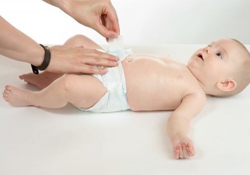 Các hướng dẫn cơ bản giúp phụ huynh bảo vệ cuống rốn của bé