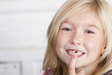 "Sún răng ở trẻ" cần làm gì để phòng tránh?