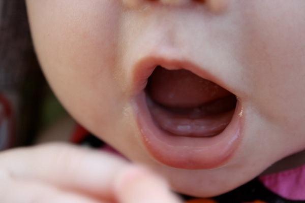 Chăm sóc khi trẻ mọc răng cần chú ý gì?