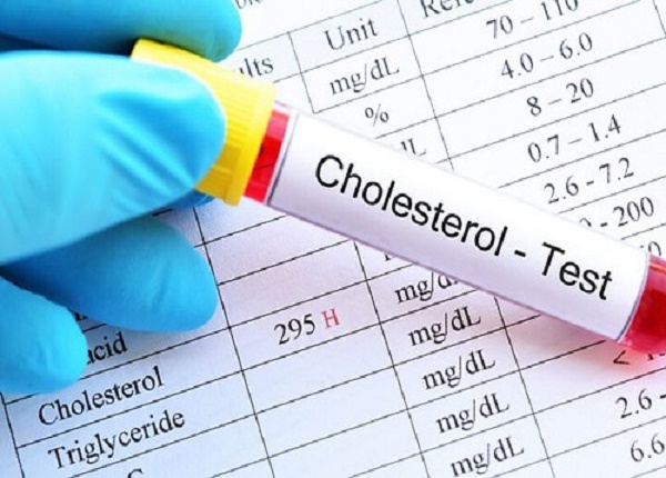 <center><em>Cholesterol cao trong máu có thể gây nhiều vấn đề sức khỏe</em></center>